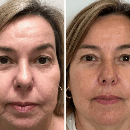 Máscara Coreana de Colagénio Rejuvenescedora Peel Off - Collagen Fit™