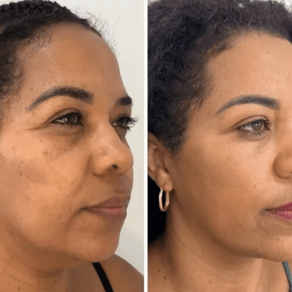 Máscara Coreana de Colagénio Rejuvenescedora Peel Off - Collagen Fit™