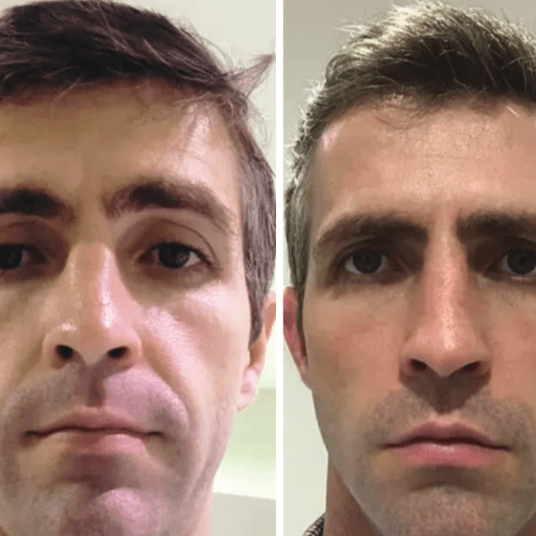 Máscara Coreana de Colagénio Rejuvenescedora Peel Off - Collagen Fit™