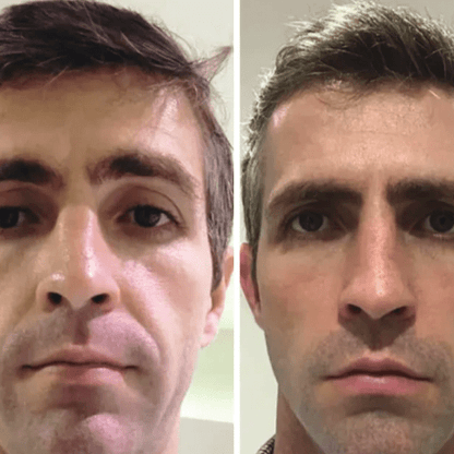 Máscara Coreana de Colagénio Rejuvenescedora Peel Off - Collagen Fit™