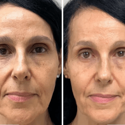 Máscara Coreana de Colagénio Rejuvenescedora Peel Off - Collagen Fit™